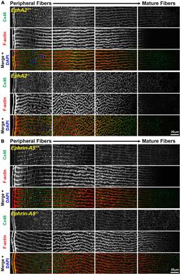 Eph-ephrin Signaling Affects Eye Lens Fiber Cell Intracellular Voltage and Membrane Conductance